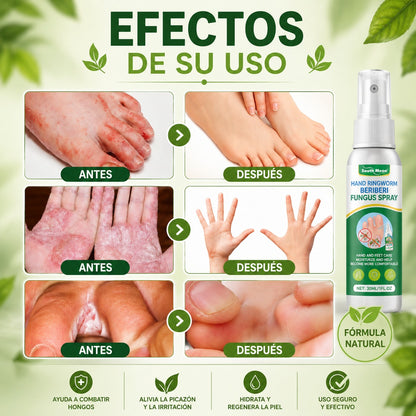 SPRAY ANTI HONGO - Oferta Especial 2x1